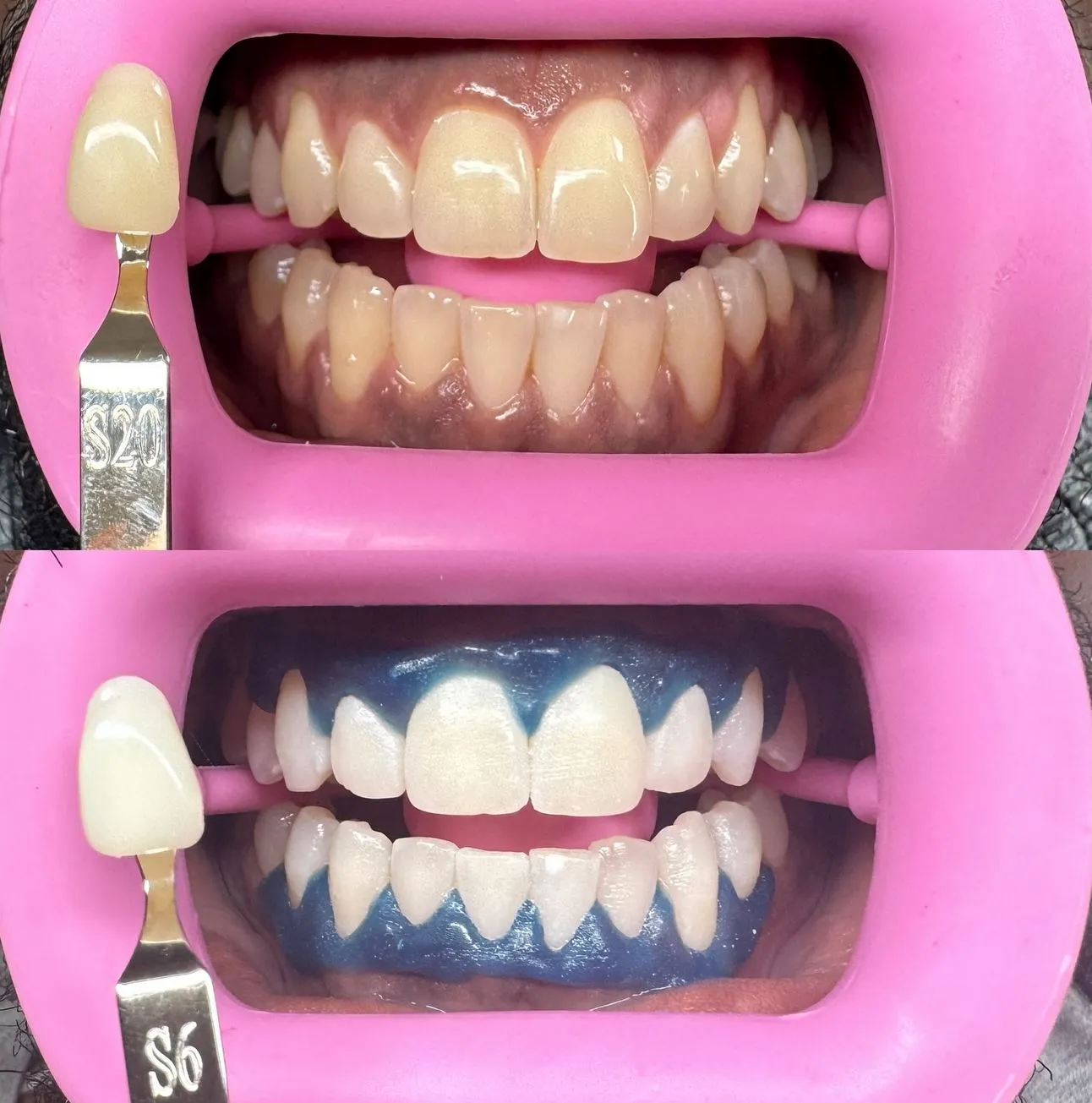 How much does it cost to start a teeth whitening business